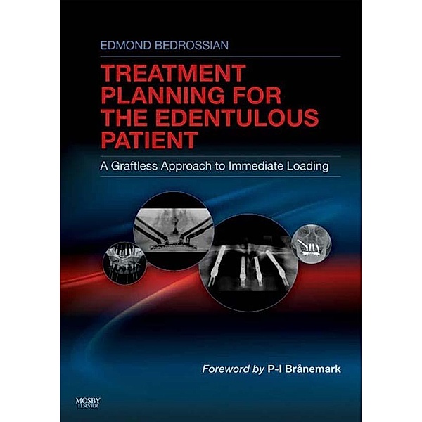 Implant Treatment Planning for the Edentulous Patient, Edmond Bedrossian