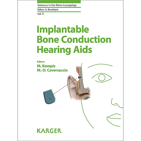 Implantable Bone Conduction Hearing Aids
