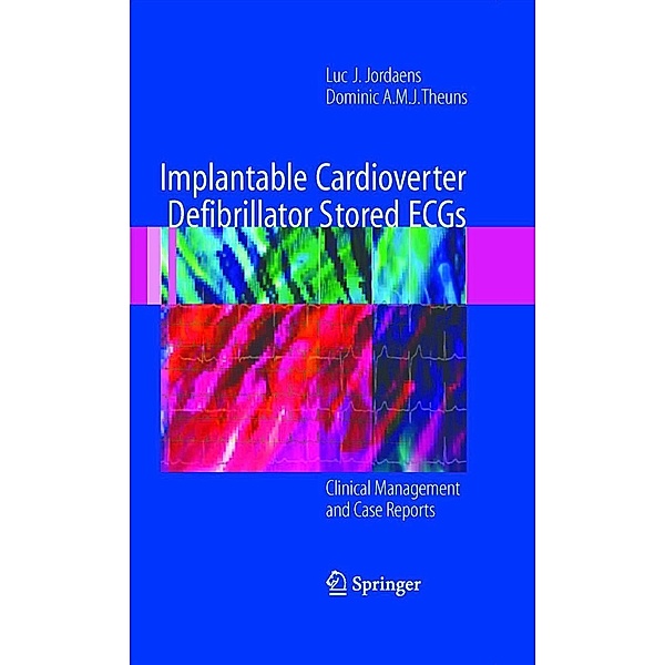 Implantable Cardioverter Defibrillator Stored ECGs, Luc J. Jordaens, Dominic A. M. J. Theuns