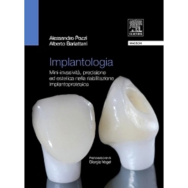 Implantologia, Alberto Barlattani, Alessandro Pozzi