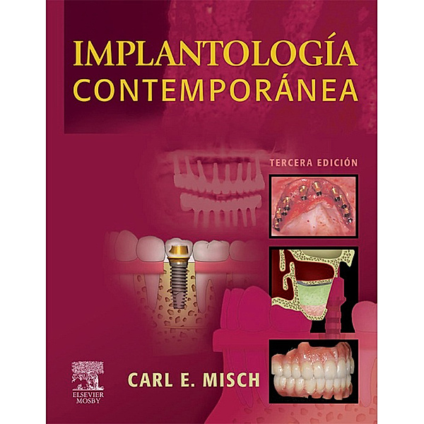 Implantología contemporánea, Carl E. Misch