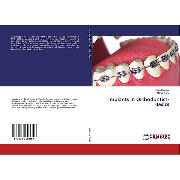 Implants in Orthodontics- Basics, Sneh Kalgotra, Mariya Qadir