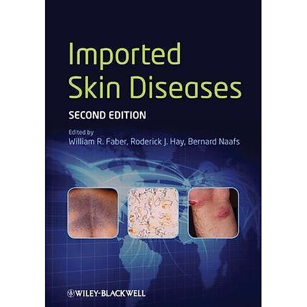 Imported Skin Diseases