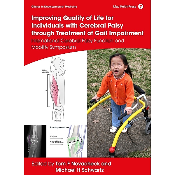 Improving Quality of Life for Individuals with Cerebral Palsy through treatment of Gait Impairment / Clinics in Developmental Medicine
