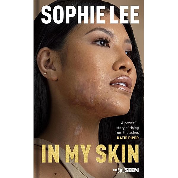 In My Skin / Katie Piper's The UnSeen, Sophie Lee