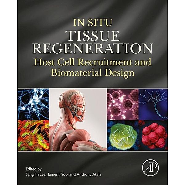 In Situ Tissue Regeneration