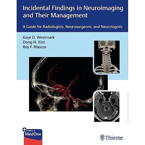 Incidental Findings in Neuroimaging and Their Management, Kaye D. Westmark, Dong H. Kim, Roy F. Riascos-Castaneda