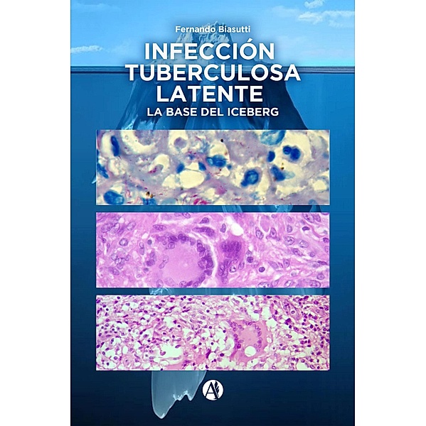 Infección Tuberculosa Latente, la base del iceberg, Fernando Biasutti