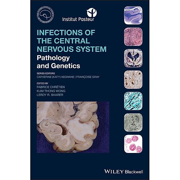 Infections of the Central Nervous System