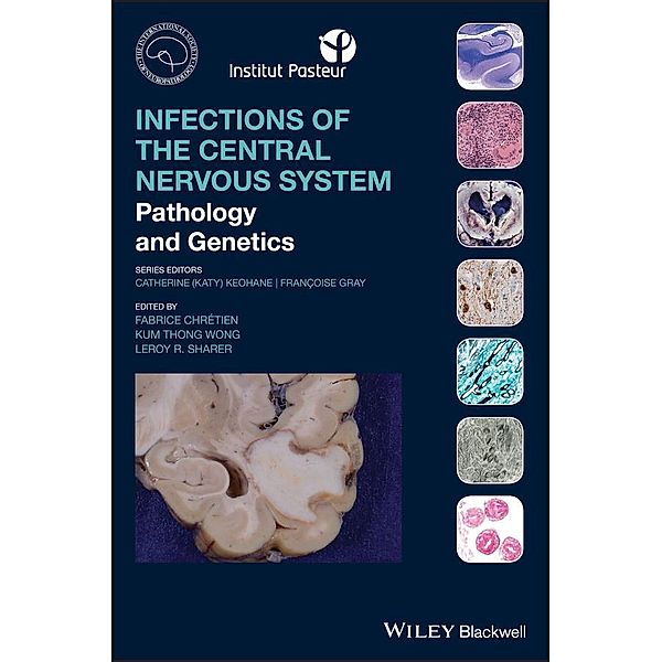 Infections of the Central Nervous System / International Society of Neuropathology Series