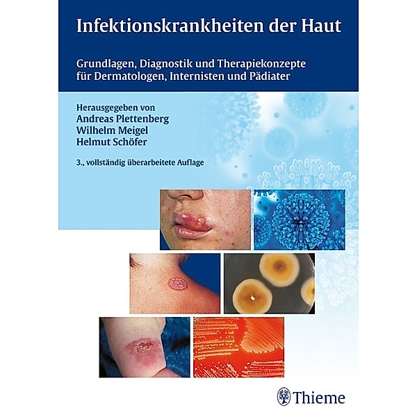 Infektionskrankheiten der Haut, Andreas Plettenberg, Wilhelm Meigel, Helmut Schöfer