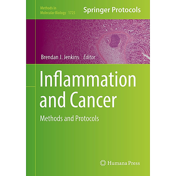 Inflammation and Cancer