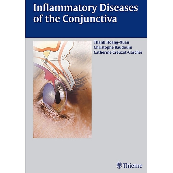 Inflammatory Diseases of the Conjuctiva, Thanh Hoang-Xuan, Catherine Creuzot-Garcher, Christophe Baudouin