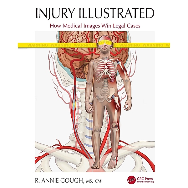 Injury Illustrated, R. Annie Gough