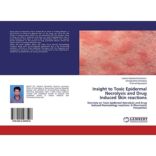 Insight to Toxic Epidermal Necrolysis and Drug Induced Skin reactions, Lakshmi Narasimha Gunturu, Girirajasekhar Dornadula, Pramod Nayanapalli