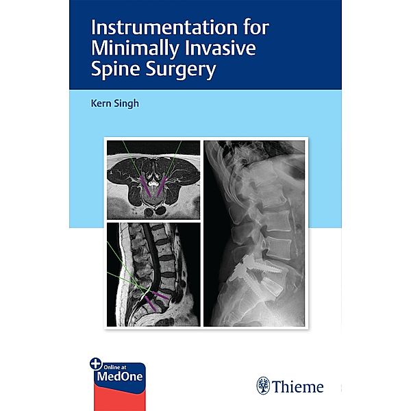 Instrumentation for Minimally Invasive Spine Surgery, Kern Singh