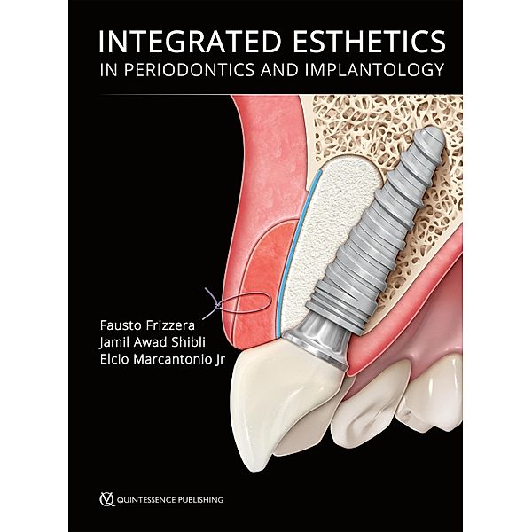 Integrated Esthetics in Periodontics and Implantology, Fausto Frizzera, Jamil Awad Shibli
