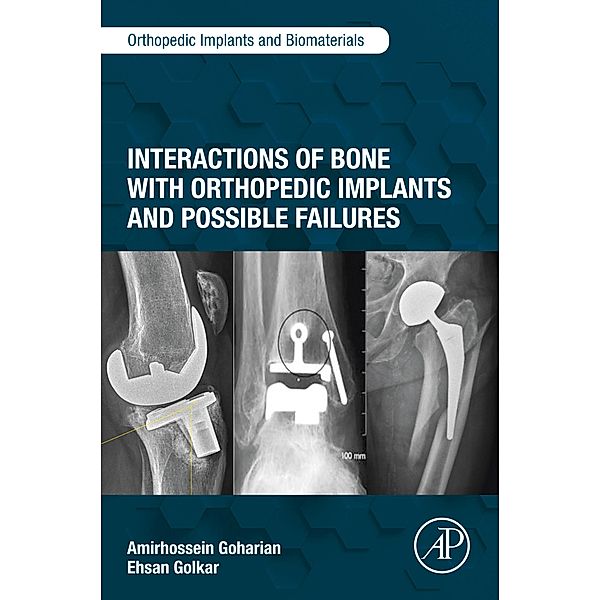 Interactions of Bone with Orthopedic Implants and Possible Failures, Amirhossein Goharian, Ehsan Golkar