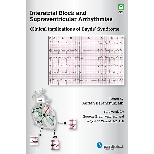 Interatrial Block and Supraventricular Arrhythmias: Clinical Implications of Bayés Syndrome