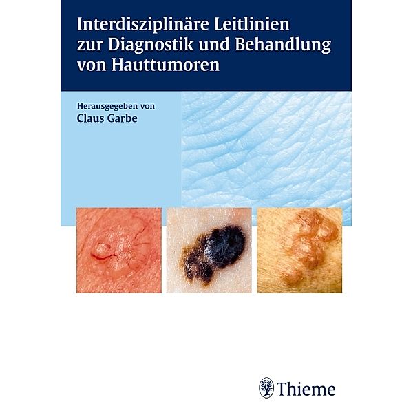 Interdisziplinäre Leitlinien zur Diagnostik und Behandlung von Hauttumoren, Claus Garbe, Holger Reimann