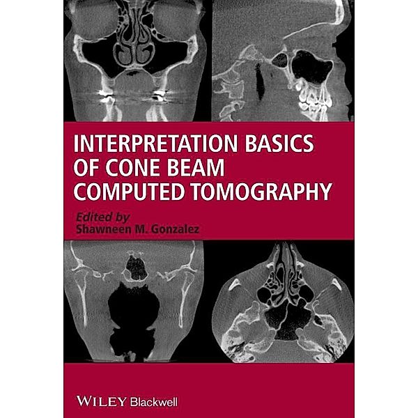 Interpretation Basics of Cone Beam Computed Tomography, Shawneen M. Gonzalez