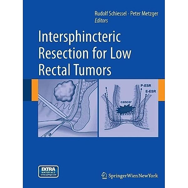 Intersphincteric Resection for Low Rectal Tumors, Peter Metzger, Rudolf Schiessel