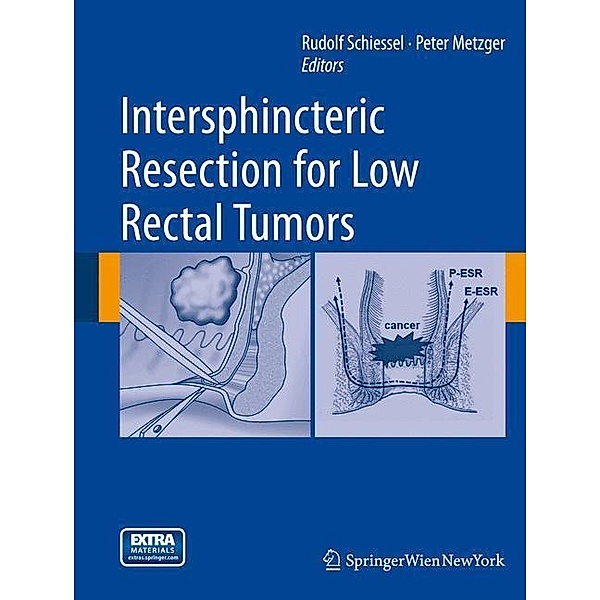 Intersphincteric Resection for Low Rectal Tumors