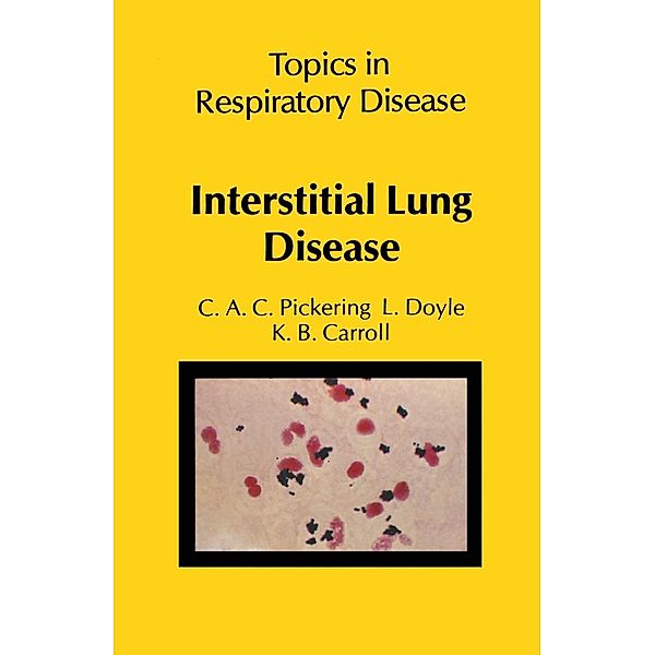 Interstitial Lung Disease, C. A. C. Pickering, L. Doyle, K. B. Carroll