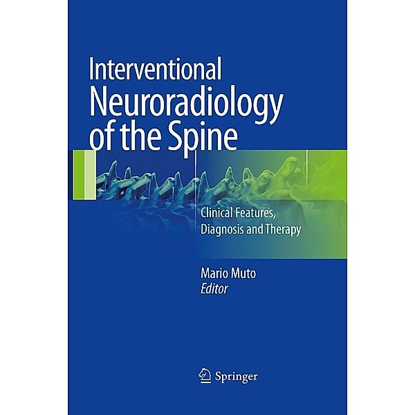 Interventional Neuroradiology of the Spine