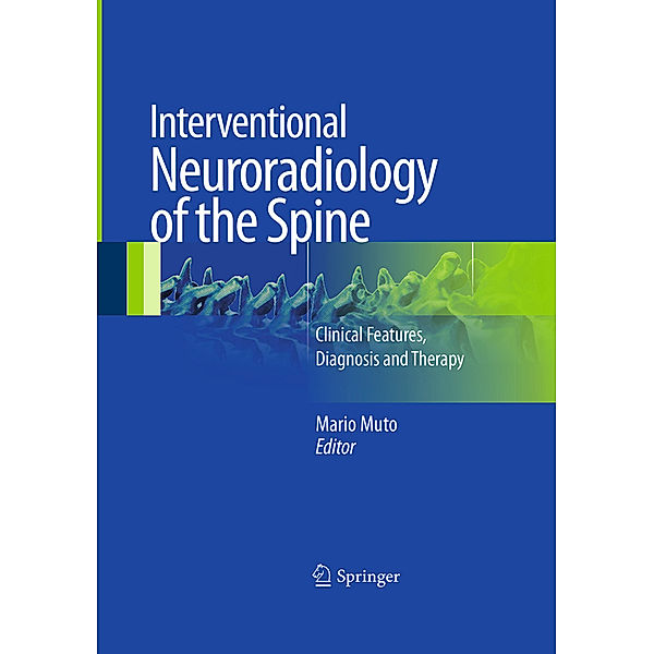 Interventional Neuroradiology of the Spine