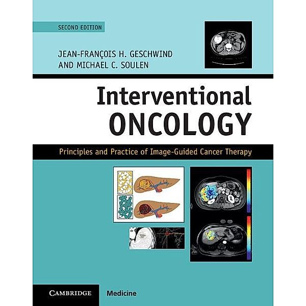 Interventional Oncology