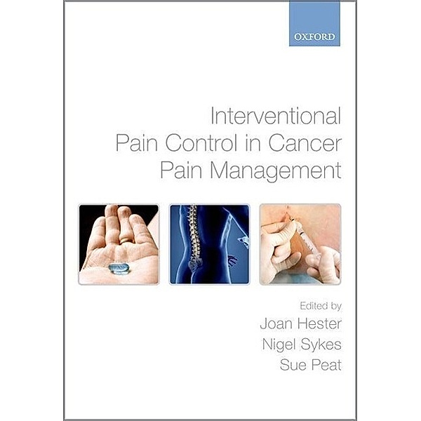 Interventional Pain Control in Cancer Pain Management, Joan Hester, Nigel Sykes, Sue Peat