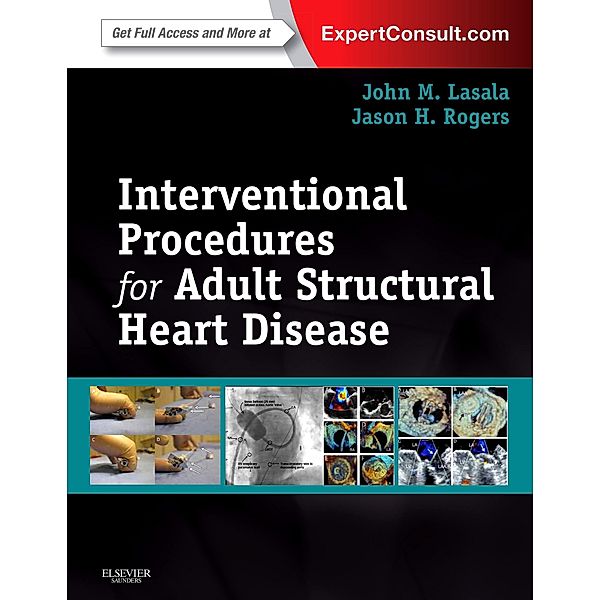 Interventional Procedures for Adult Structural Heart Disease E-Book, John M Lasala, Jason H. Rogers