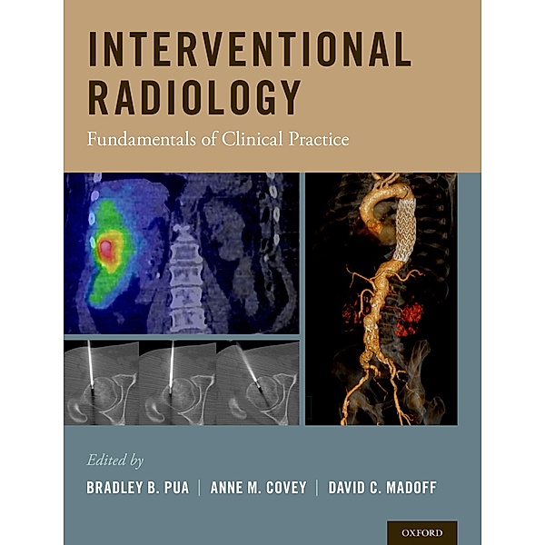 Interventional Radiology