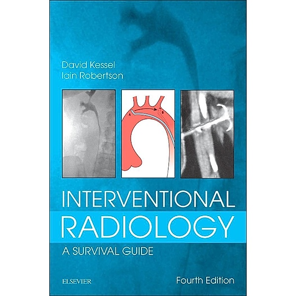 Interventional Radiology: A Survival Guide E-Book, David Kessel, Iain Robertson
