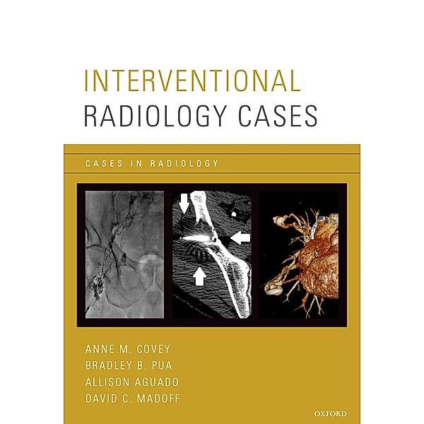 Interventional Radiology Cases