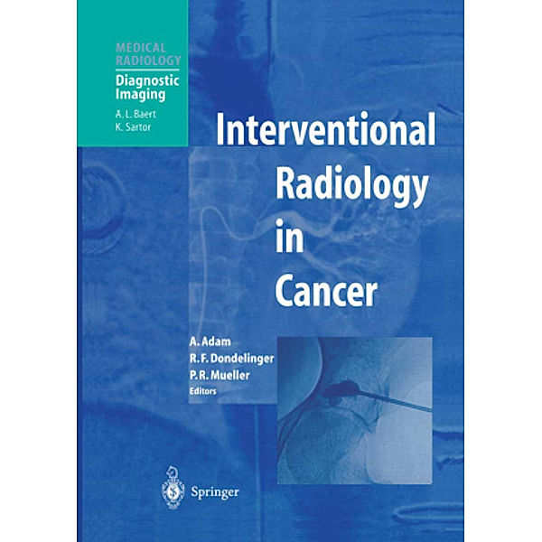 Interventional Radiology in Cancer