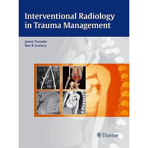 Interventional Radiology in Trauma Management, Jaime Tisnado, Rao R Ivatury