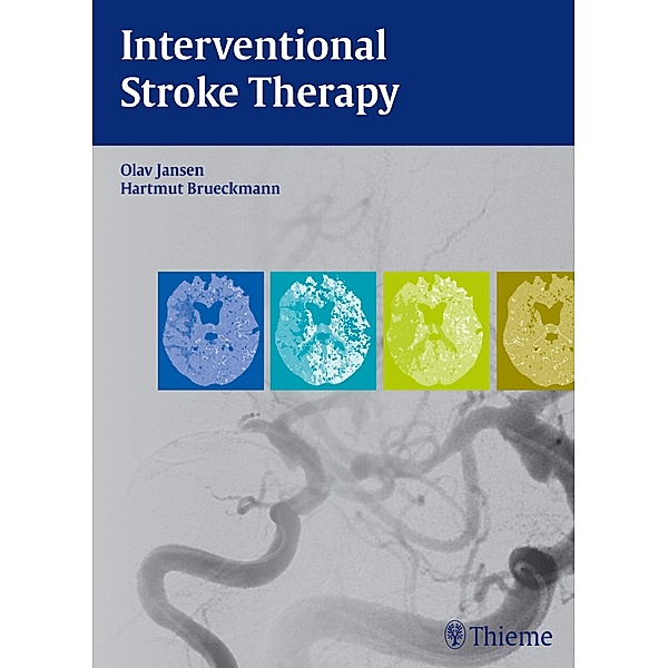 Interventional Stroke Therapy, Olav Jansen, Hartmut Brückmann