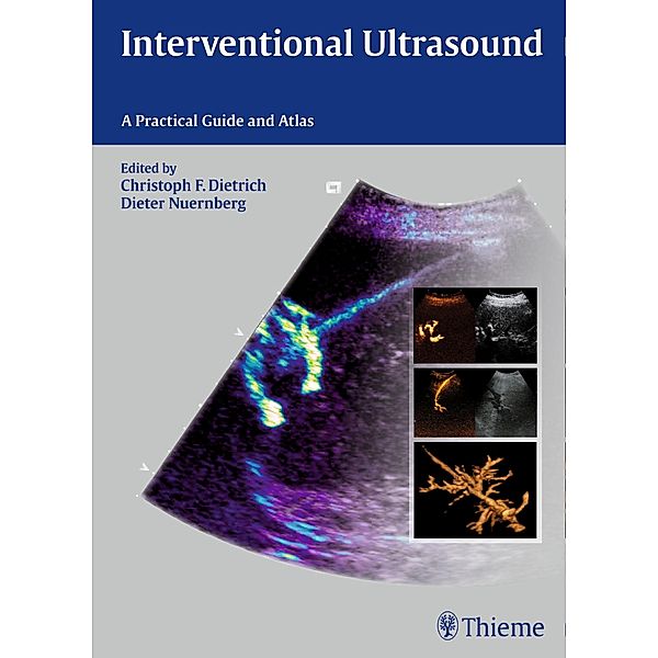 Interventional Ultrasound, Dieter Nürnberg, Christoph Frank Dietrich