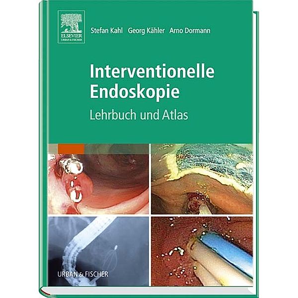 Interventionelle Endoskopie