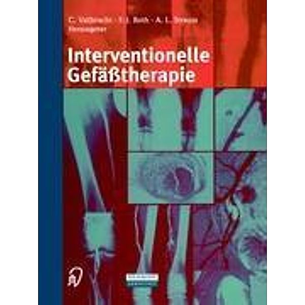 Interventionelle Gefäßtherapie, M. Kaltenbach, W. Schoop