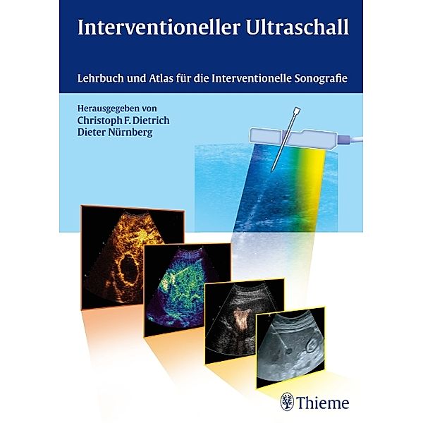 Interventioneller Ultraschall