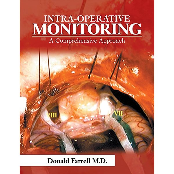 Intra-Operative Monitoring, Donald Farrell MD