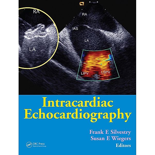 Intracardiac Echocardiography, Frank E. Silvestry, Susan E. Wiegers