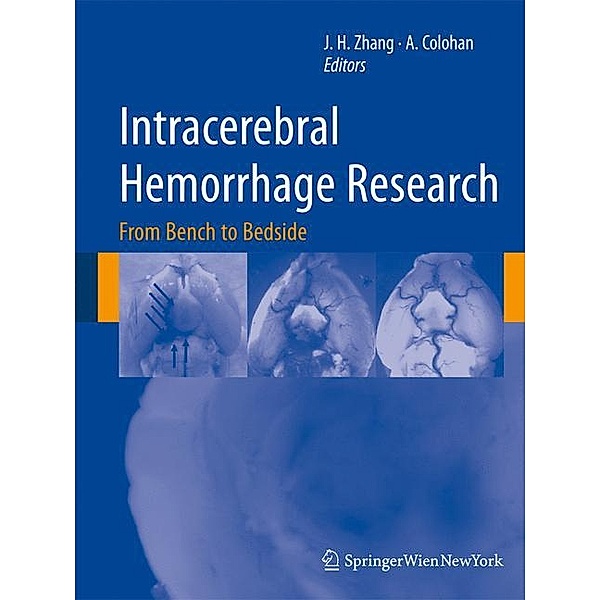 Intracerebral Hemorrhage Research