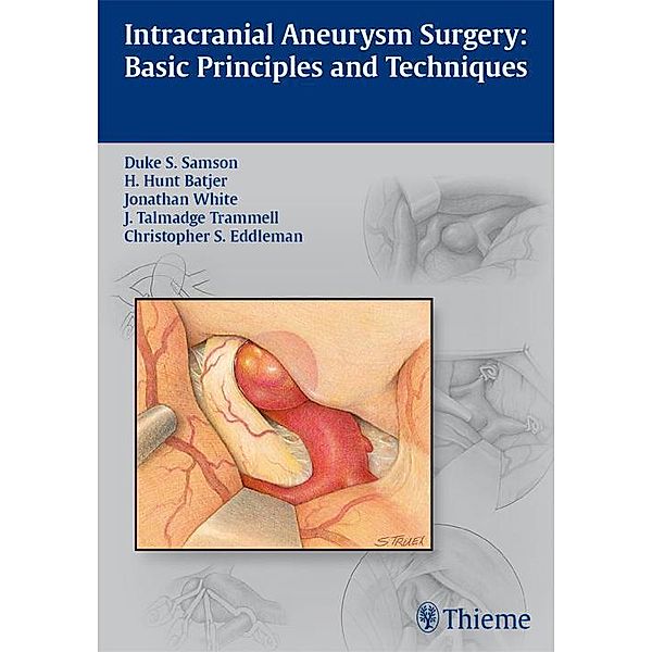 Intracranial Aneurysm Surgery