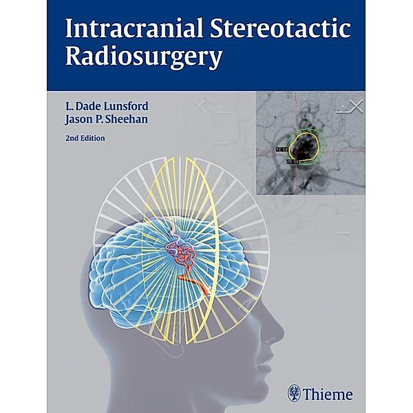 Intracranial Stereotactic Radiosurgery