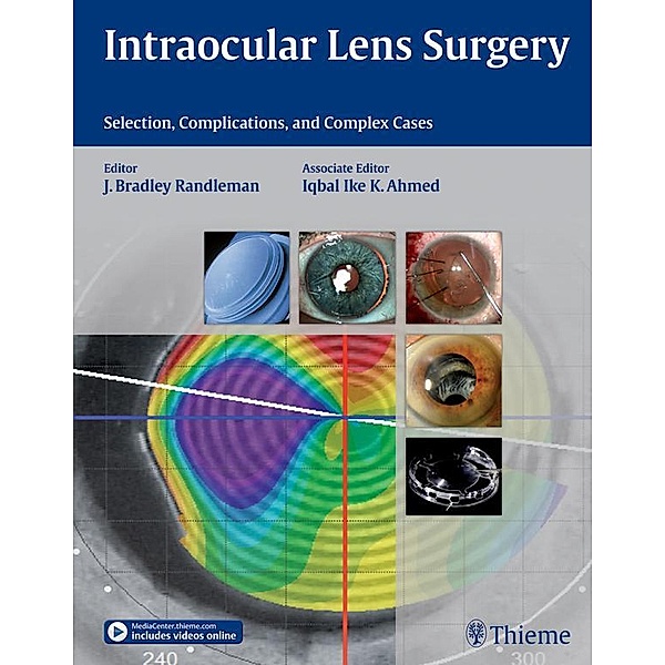 Intraocular Lens Surgery, Bradley Randleman, Iqbal Ike K Ahmed