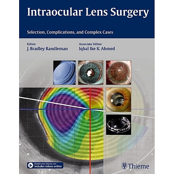 Intraocular Lens Surgery, Bradley Randleman, Iqbal Ike K. Ahmed